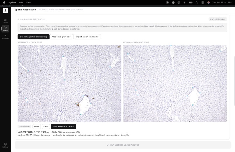 OASIS-Open Access Spatial IHC System – screenshot 3
