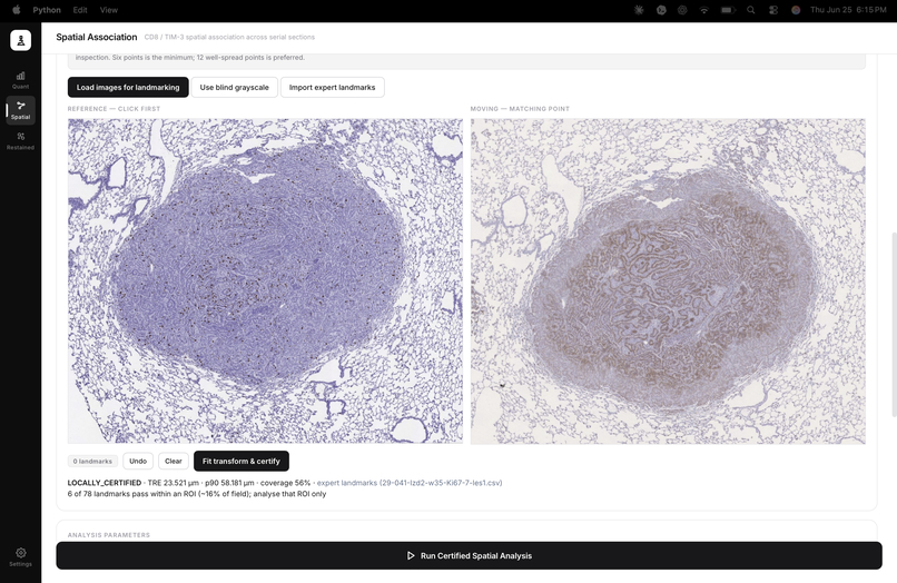 OASIS-Open Access Spatial IHC System – screenshot 4