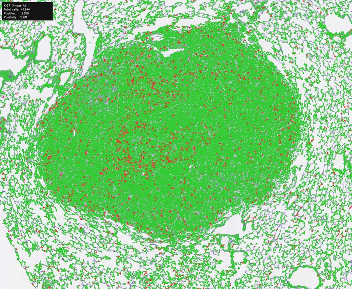 OASIS-Open Access Spatial IHC System – screenshot 6