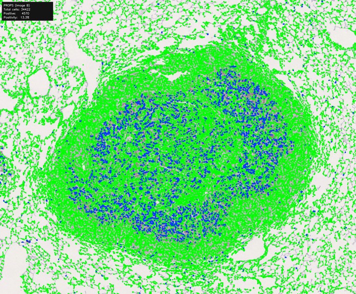 OASIS-Open Access Spatial IHC System – screenshot 7