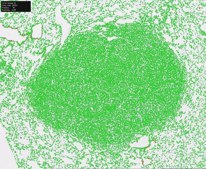 OASIS-Open Access Spatial IHC System – screenshot 10
