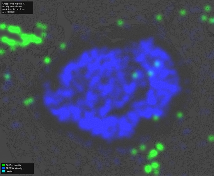 OASIS-Open Access Spatial IHC System – screenshot 12
