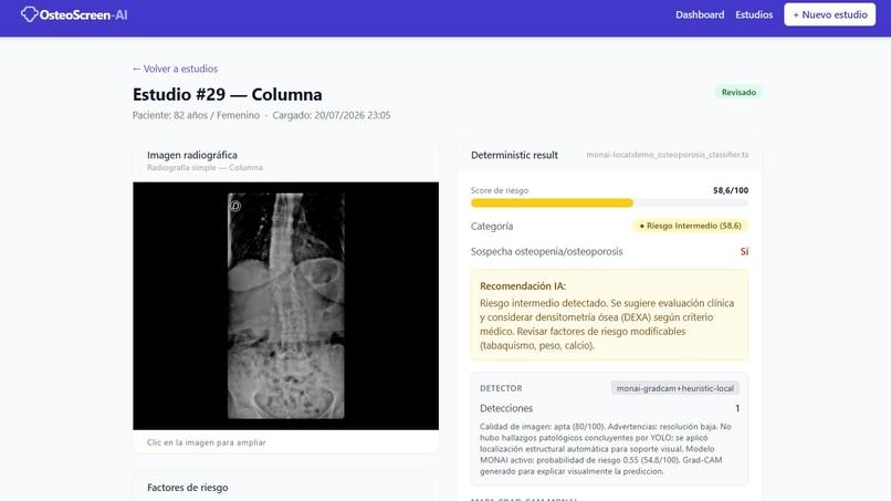 OsteoScreen-AI – screenshot 3