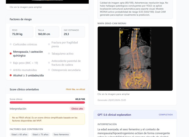 OsteoScreen-AI – screenshot 4
