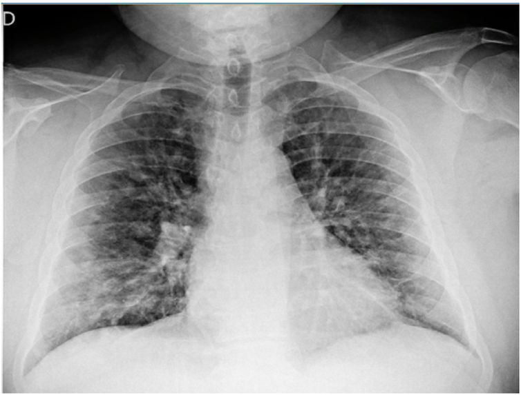 RadiAI: Explainable Chest X-Ray Diagnosis Assistant  – screenshot 1