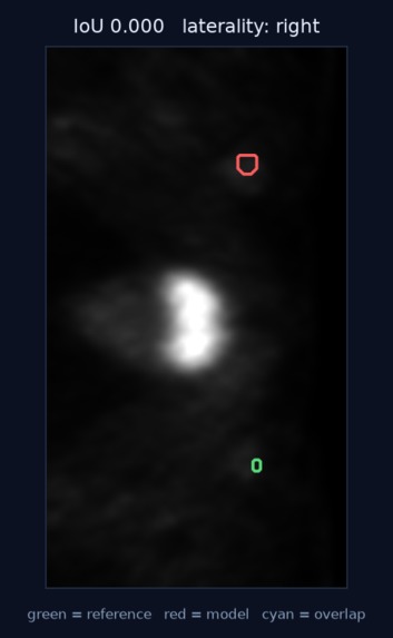 VASCTRACE AI – screenshot 4