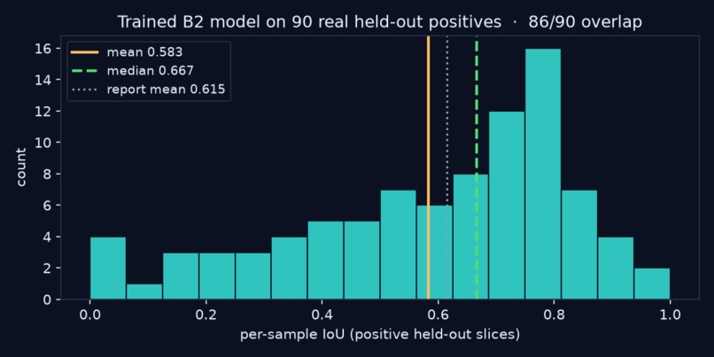 VASCTRACE AI – screenshot 5