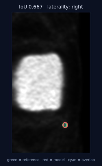 VASCTRACE AI – screenshot 6
