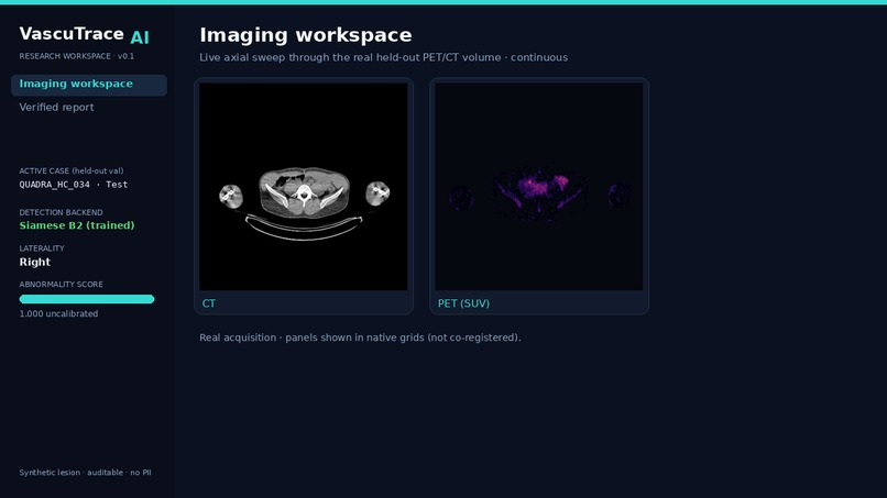 VASCTRACE AI – screenshot 7