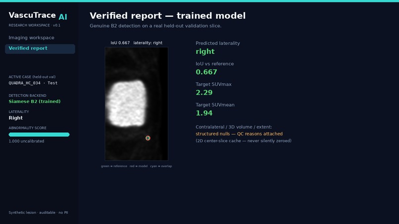 VASCTRACE AI – screenshot 9