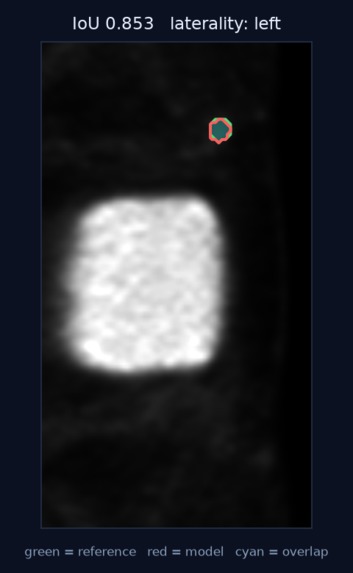 VASCTRACE AI – screenshot 11