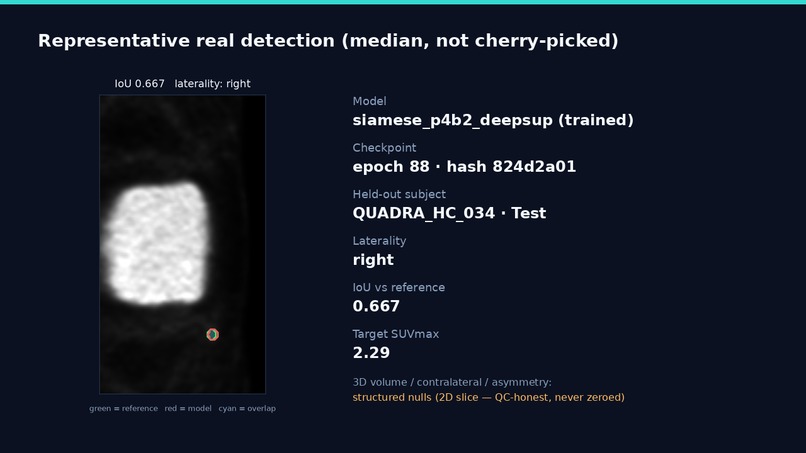 VASCTRACE AI – screenshot 12