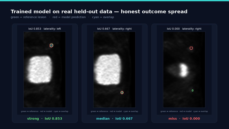 VASCTRACE AI – screenshot 13