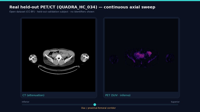 VASCTRACE AI – screenshot 14