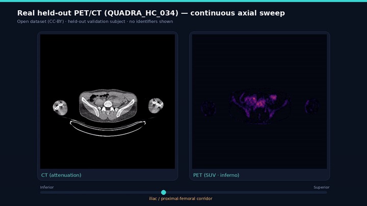 VASCTRACE AI – screenshot 15