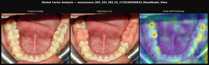SmileScreen – screenshot 1