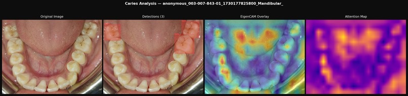 SmileScreen – screenshot 3