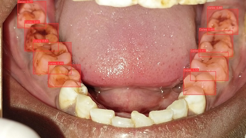 SmileScreen – screenshot 2