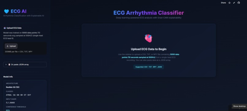 Arrhythmia Classification with Explainable AI  – screenshot 1