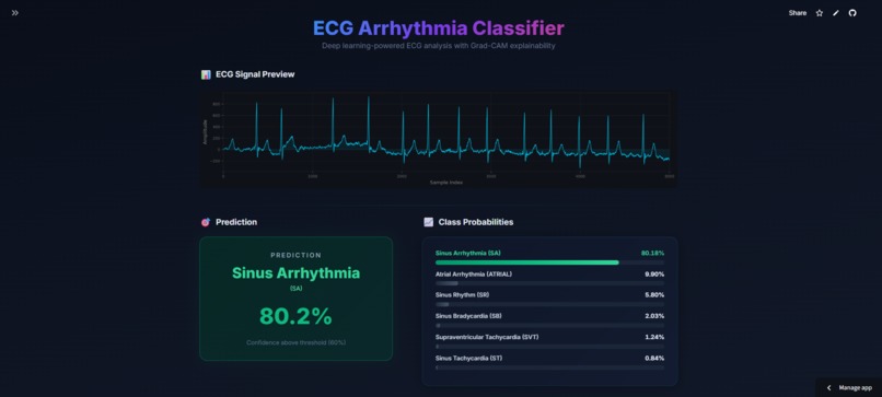 Arrhythmia Classification with Explainable AI  – screenshot 2