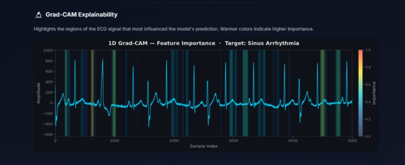 Arrhythmia Classification with Explainable AI  – screenshot 3
