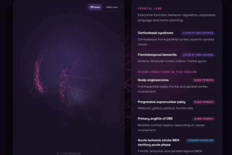 NeuLitTrace – screenshot 3