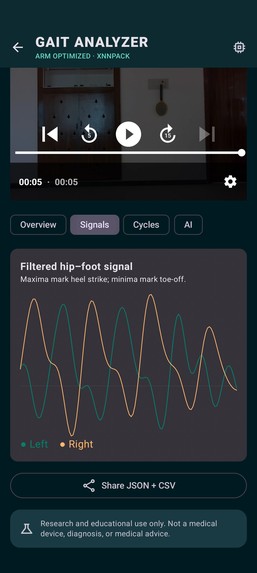 Gait Analyzer Arm – screenshot 2