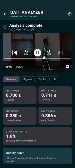 Gait Analyzer Arm – screenshot 1
