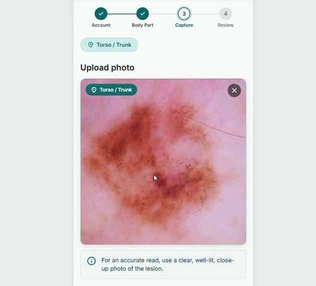 Dermalyze – screenshot 1