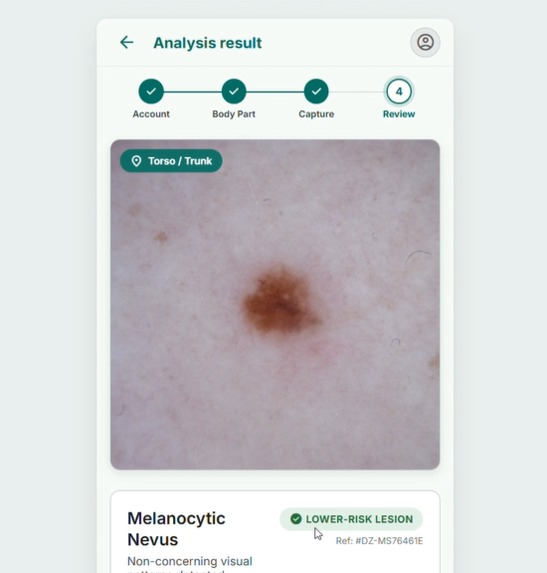 Dermalyze – screenshot 5