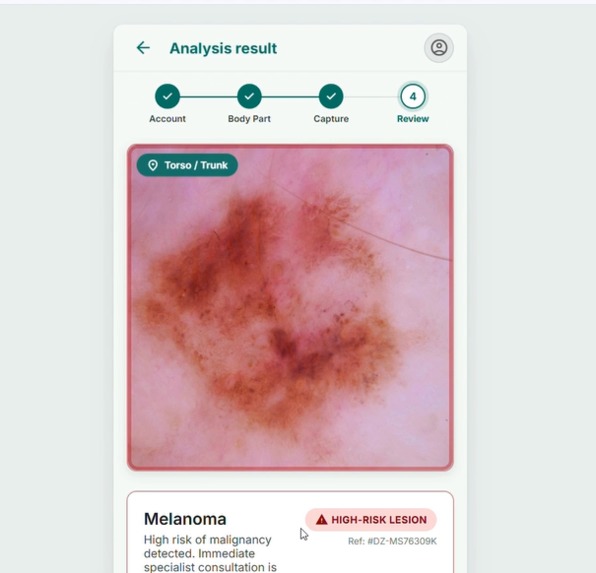 Dermalyze – screenshot 2