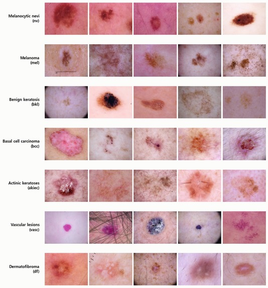 Dermalyze – screenshot 7