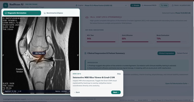 RadScan AI – screenshot 8