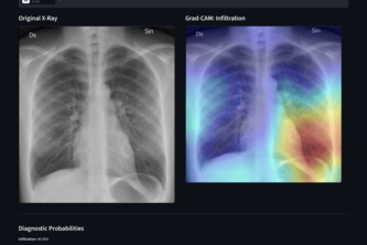 Chest X-Ray Analysis: Medical Image Diagnostic Pipeline