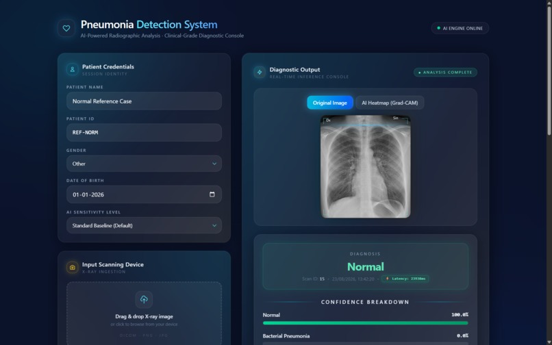 Pneumonia-Detector – screenshot 6