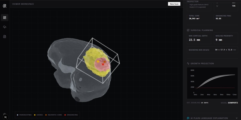 NeuroVista-AI – screenshot 4