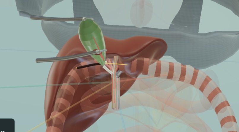 seeIn – screenshot 3