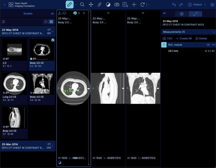 Agent-Enabled OHIF Viewer – screenshot 1