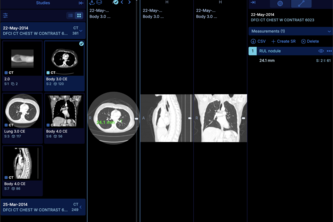 Agent-Enabled OHIF Viewer