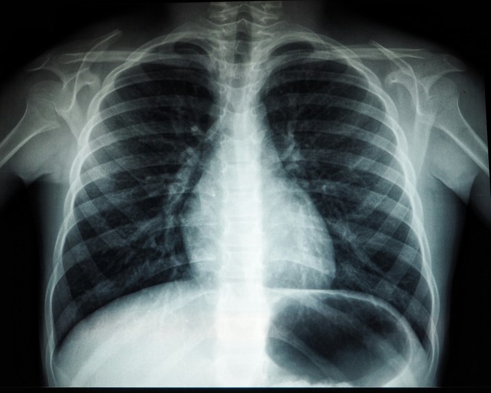 MedSight AI – screenshot 2
