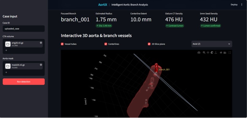 AortiX — Intelligent Aortic Branch Analysis – screenshot 1