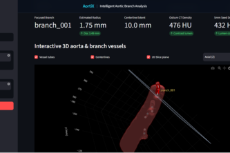 AortiX — Intelligent Aortic Branch Analysis