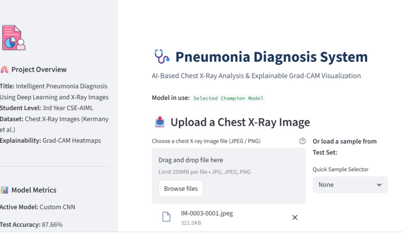 Intelligent Pneumonia Detection Using Deep Learning – screenshot 1