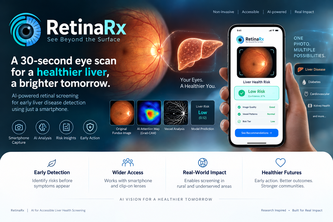 RetinaRx