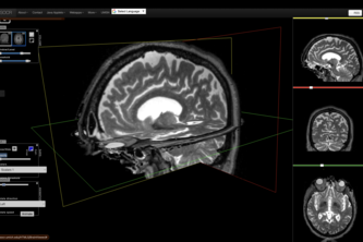 Cross-Modal 3D Brain Tumor MRI Retrieval
