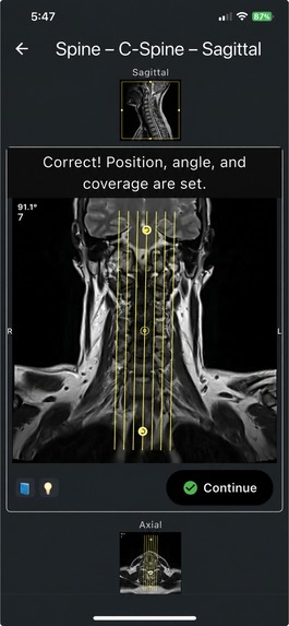 MRI Plan – screenshot 3