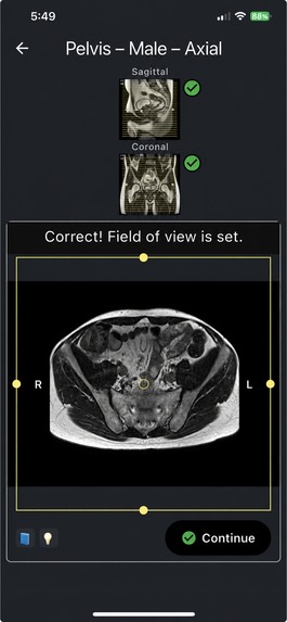 MRI Plan – screenshot 4