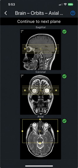 MRI Plan – screenshot 5