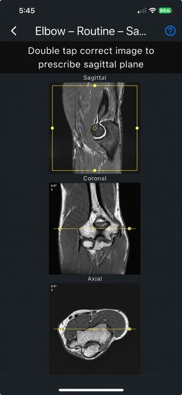 MRI Plan – screenshot 6