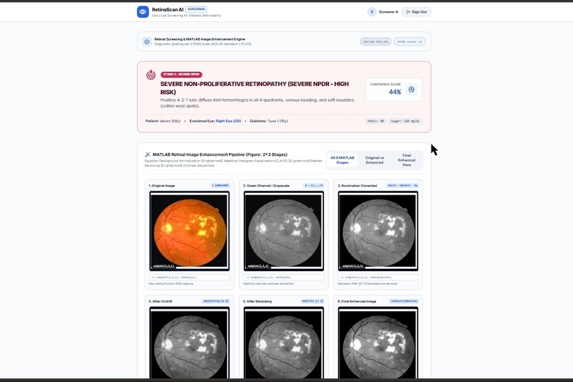 RetinaScan AI – screenshot 8